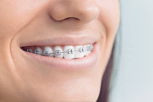 Best Invisalign and Clear Aligners  in Monte Sereno, CA